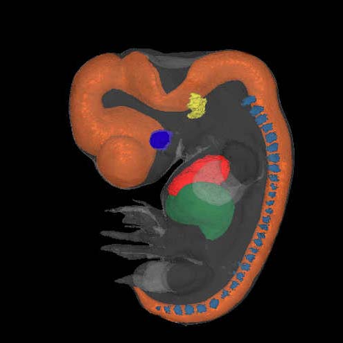 A 3D model of a human embryo, Carnegie stage 17