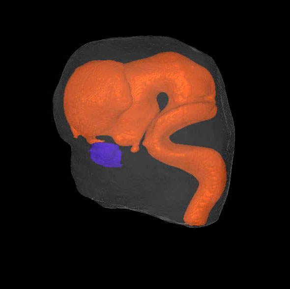 A 3D model of the head of a human embryo, Carnegie stage 23
