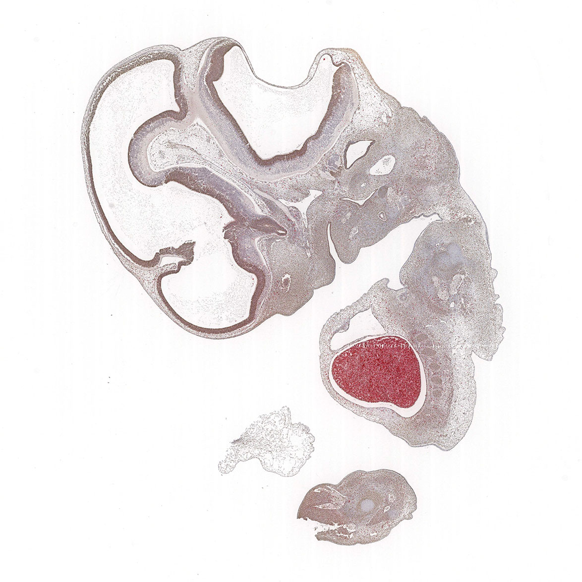 CS18 Human embryo