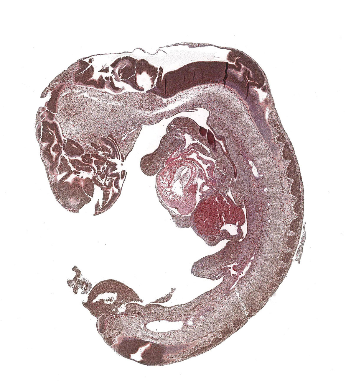 CS12 Human embryo
