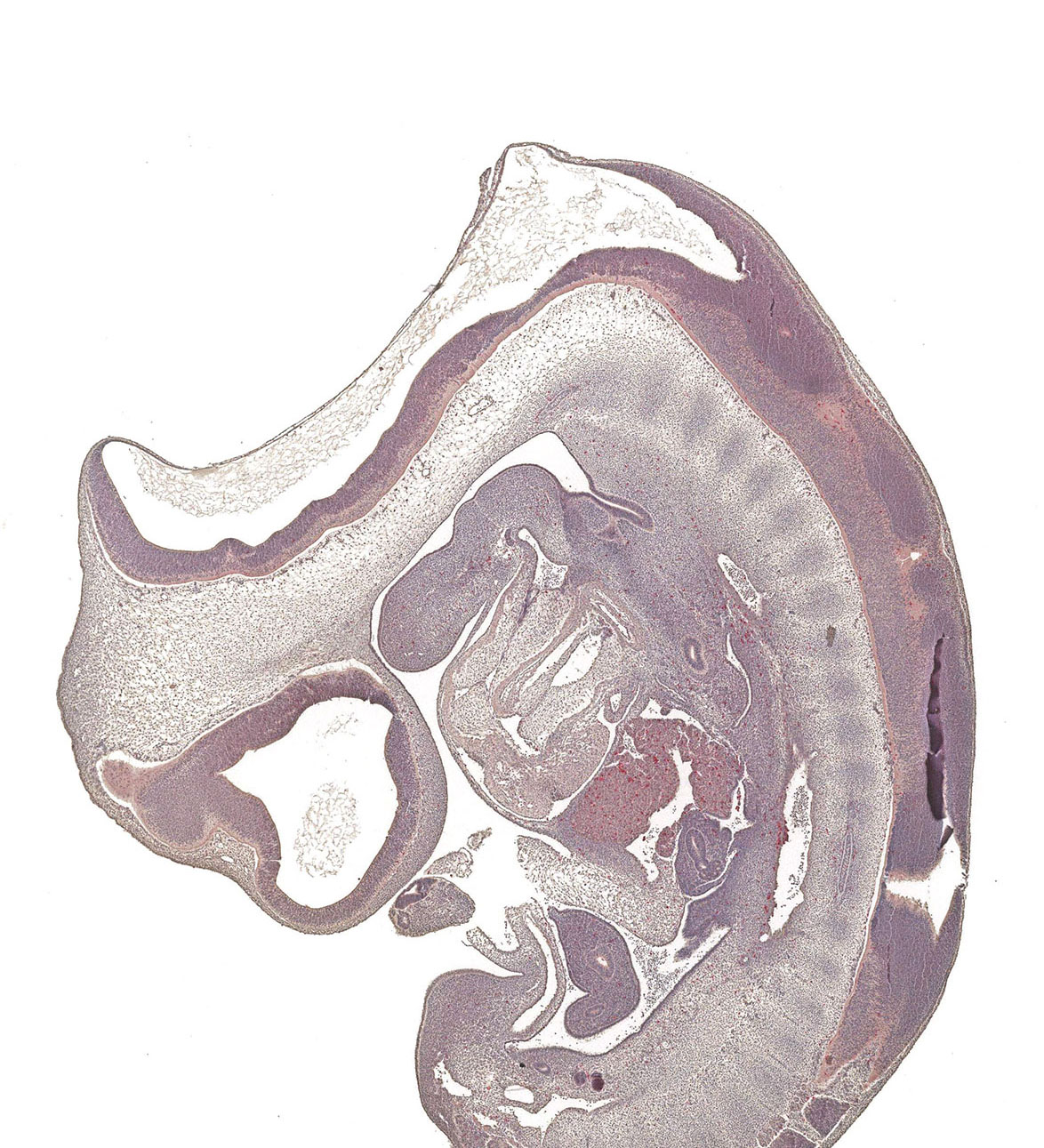 CS14 Human embryo