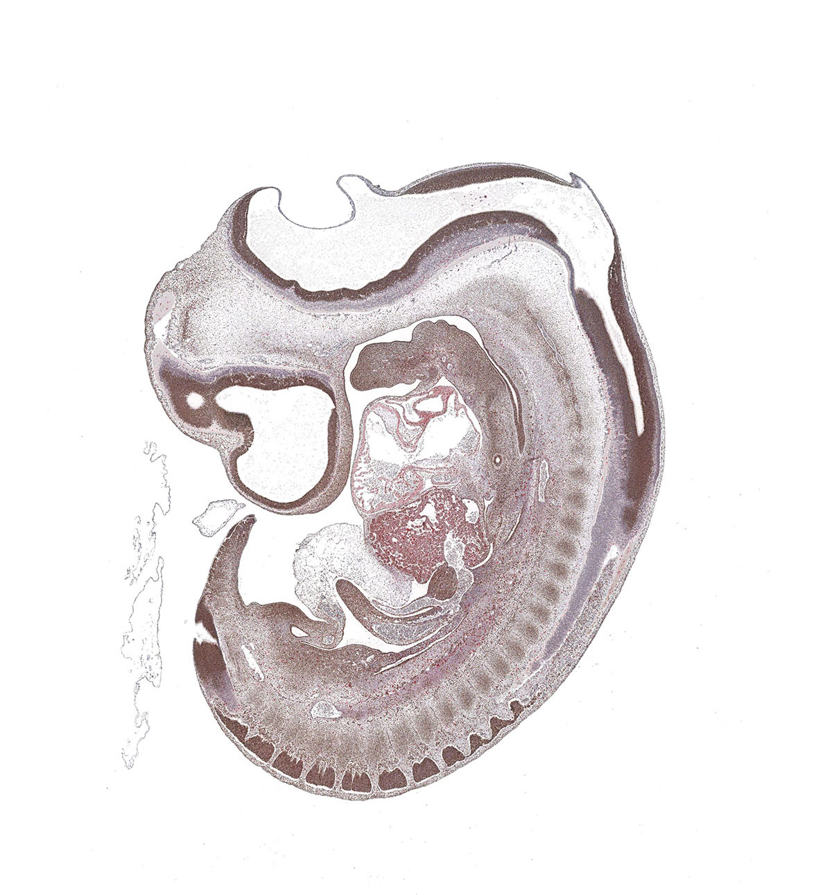CS16 Human embryo