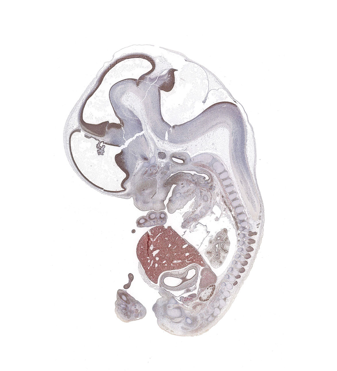 CS21 Human embryo