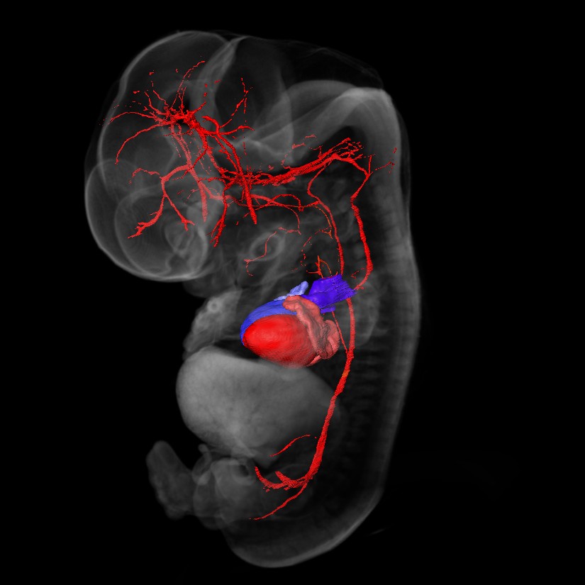 3D model of a human embryonic brain