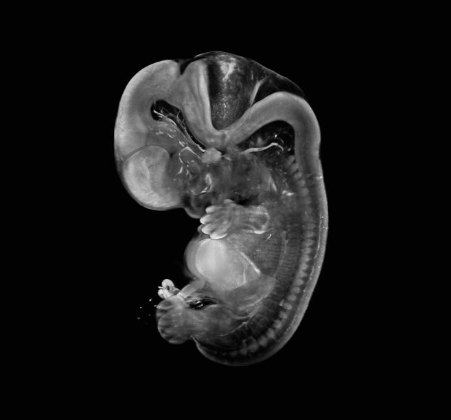 3D model of a human embryo