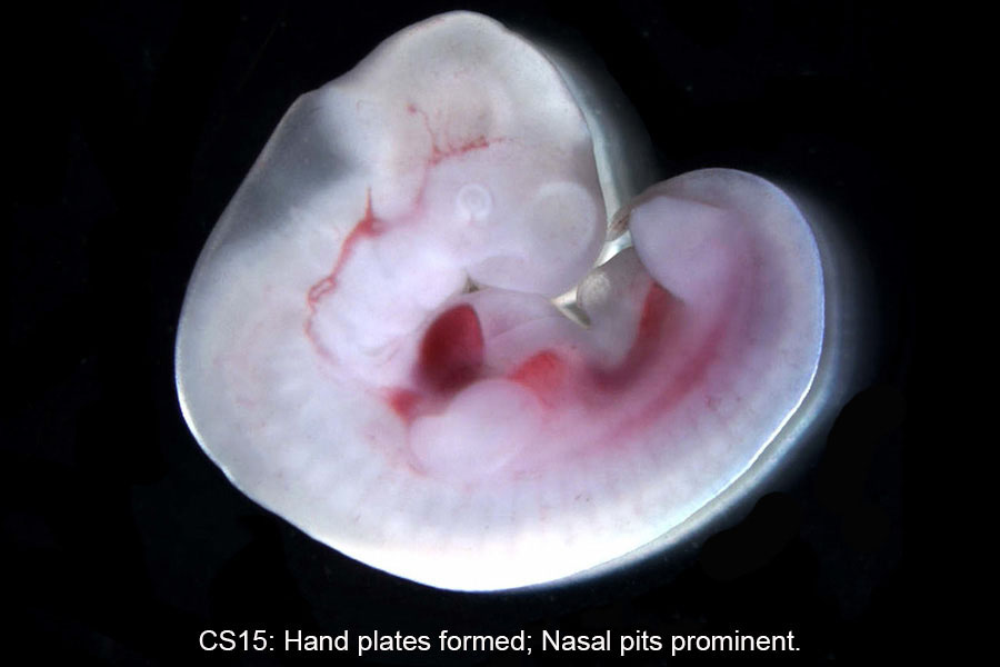 A human embryo, Carnegie Stage 15