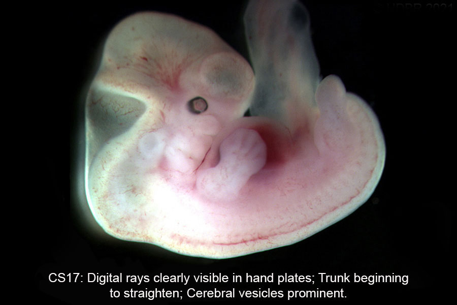 A human embryo, Carnegie Stage 17