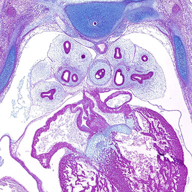 Alcian blue PAS section of a human embryo