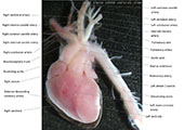 A human fetal heart