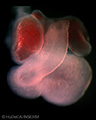A human embryonic heart