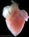 A human embryonic heart