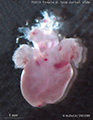 A human fetal heart