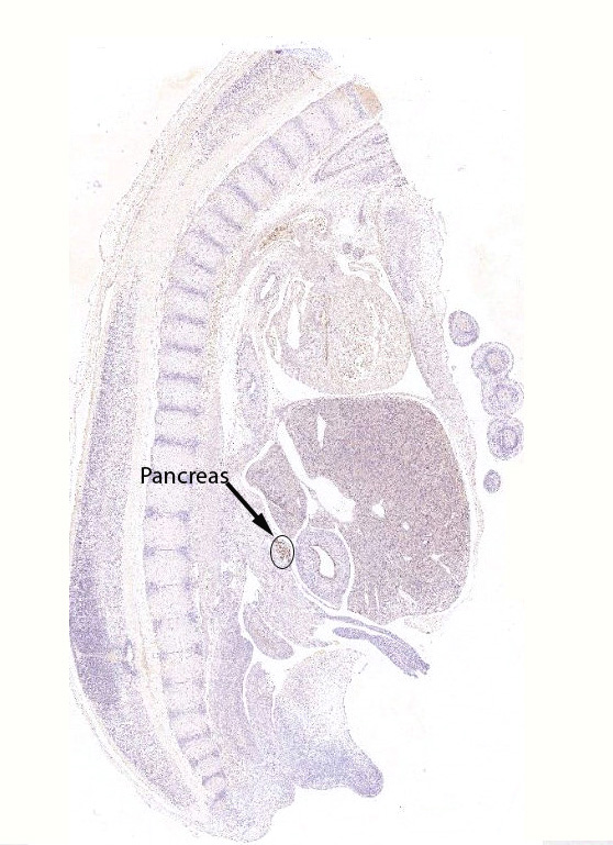 Gene expression in the human fetal pancreas