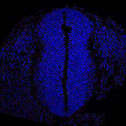 Protein expression in the human embryonic spinal cord