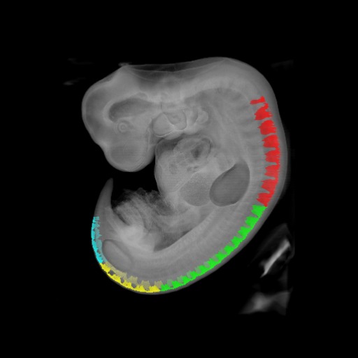 A 3D model of a human embryo