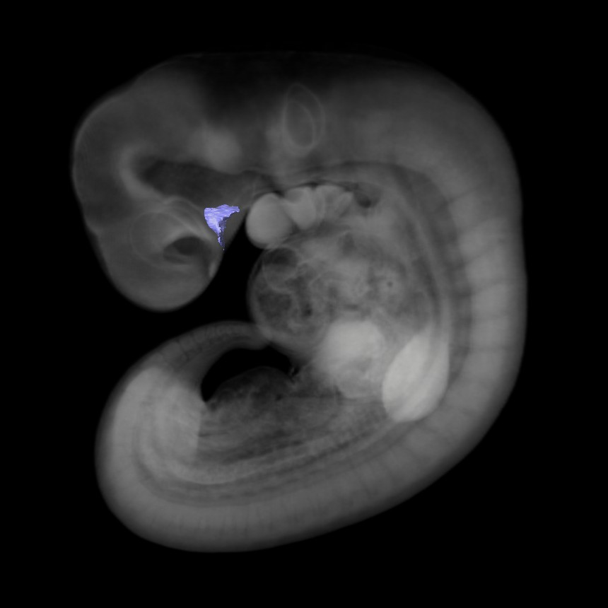 3D model of the human embryonic gastro-intestinal tract