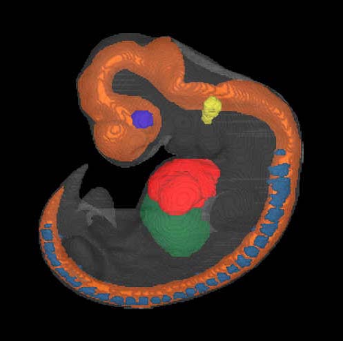 a 3D model of a human embryo, Carnegie stage 16
