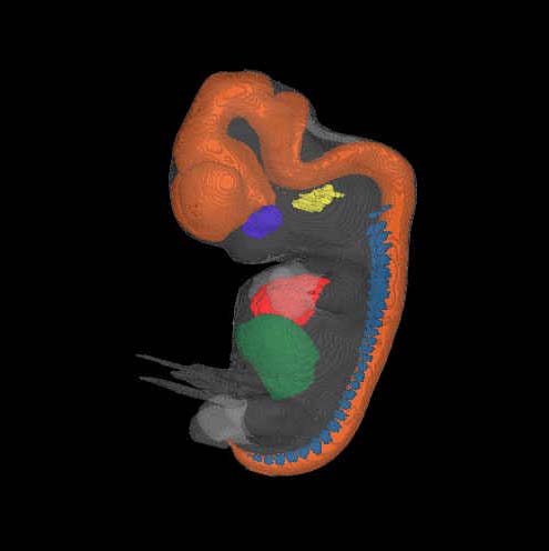 a 3D model of a human embryo