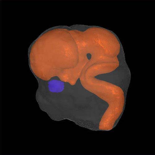 A 3D model of the head of a human embryo
