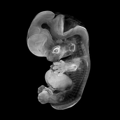 A 3D model of a human embryo, Carnegie stage 20