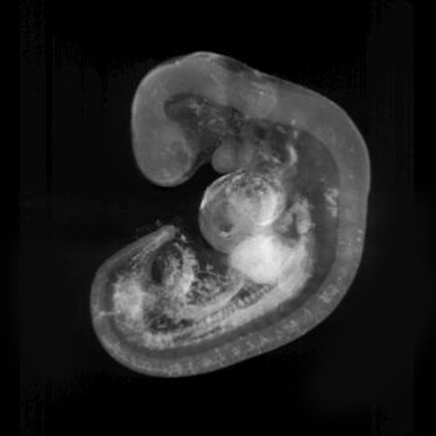 A 3D model of a human embryo, Carnegie stage 13