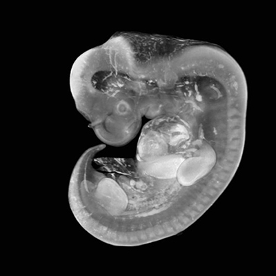 A 3D model of a human embryo, Carnegie stage 15