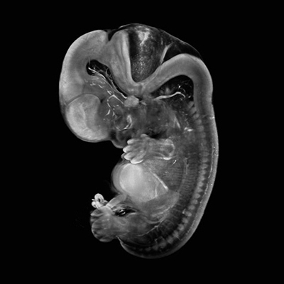 A 3D model of a human embryo, Carnegie stage 19