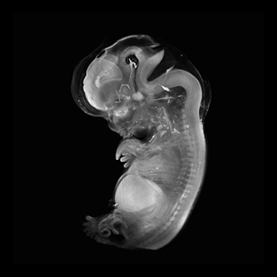 A 3D model of a human embryo, Carnegie stage 21