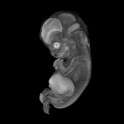 A 3D model of a human embryo, Carnegie stage 22