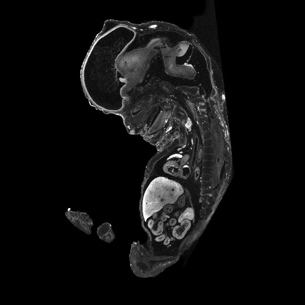 A 3D model of a human fetus