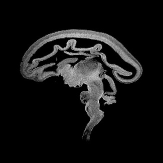 A 3D model of a human fetal brain