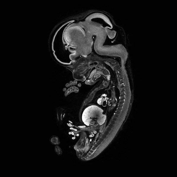 A 3D model of a human fetus