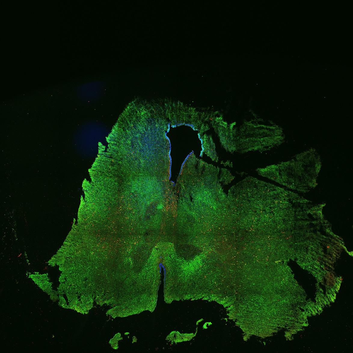 Human foetal midbrain