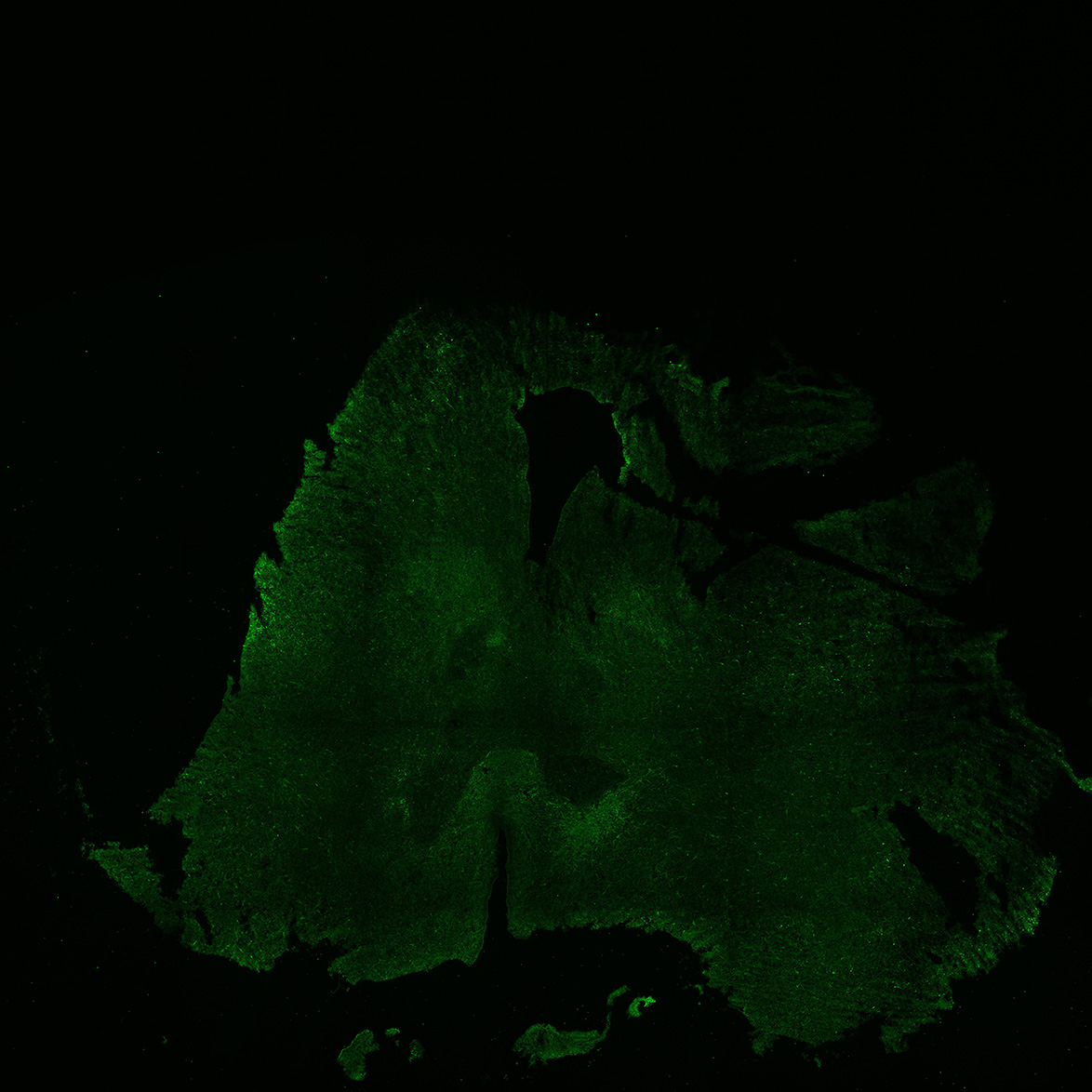 Human foetal midbrain