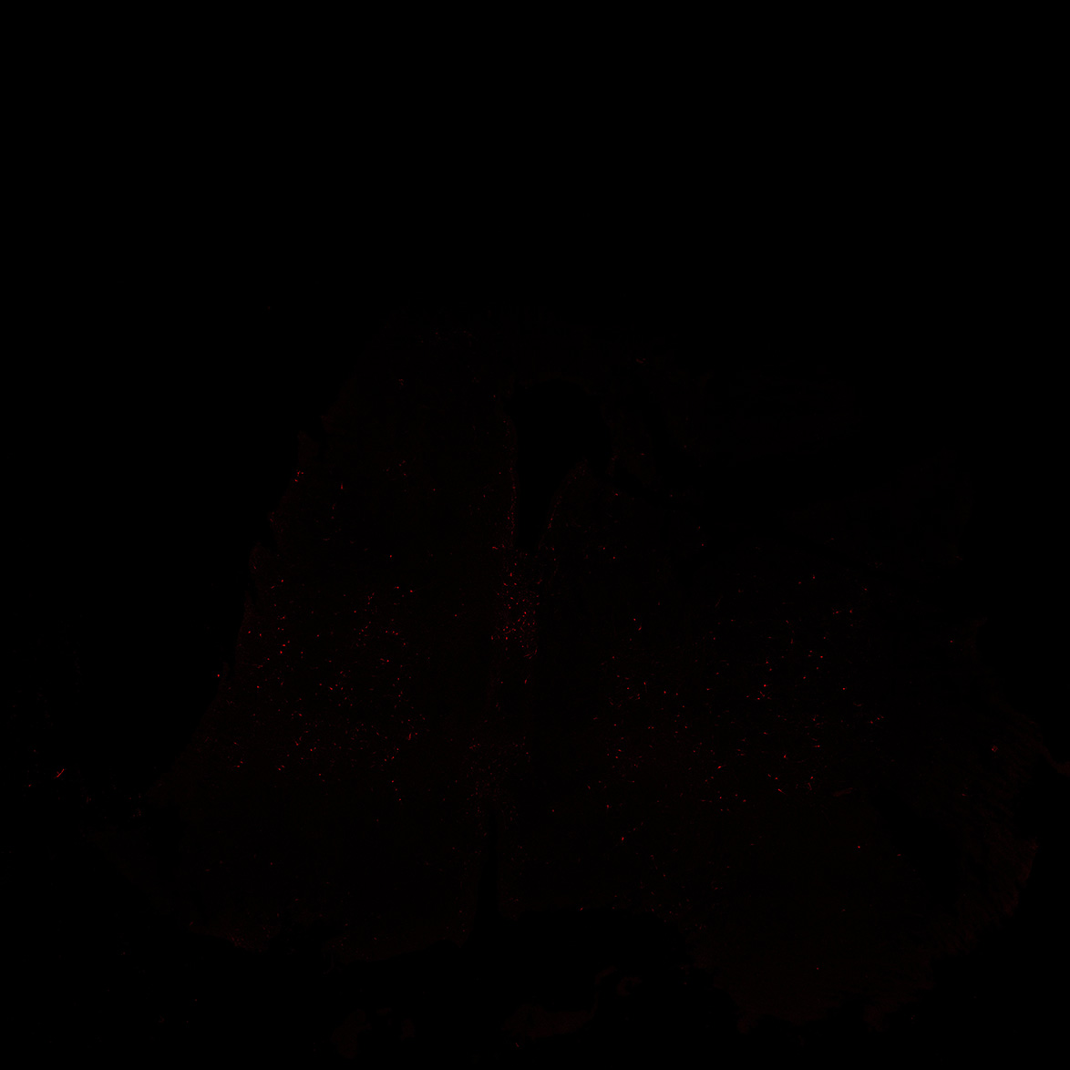 Human foetal midbrain