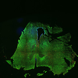 15PCW human midbrain