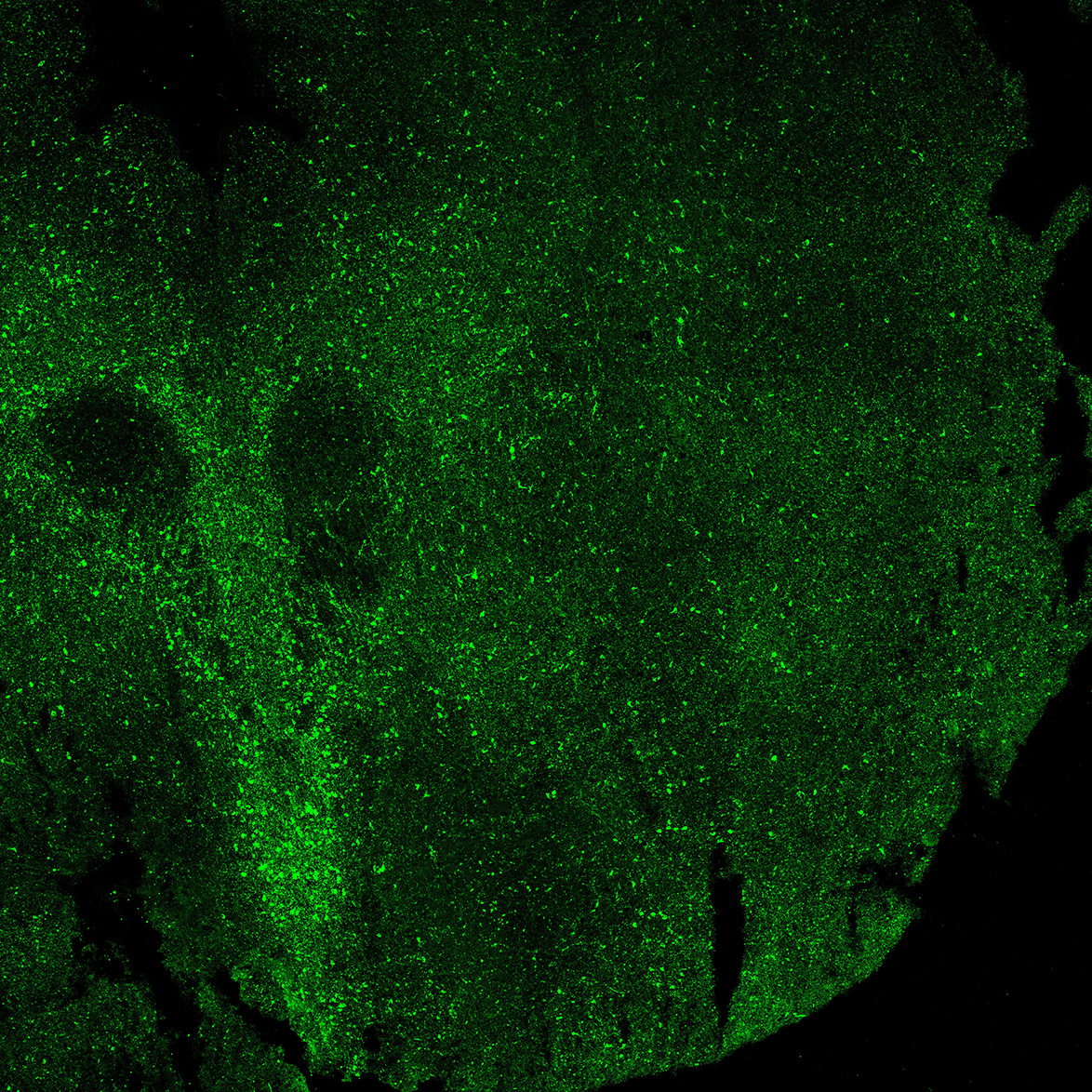 Human foetal midbrain