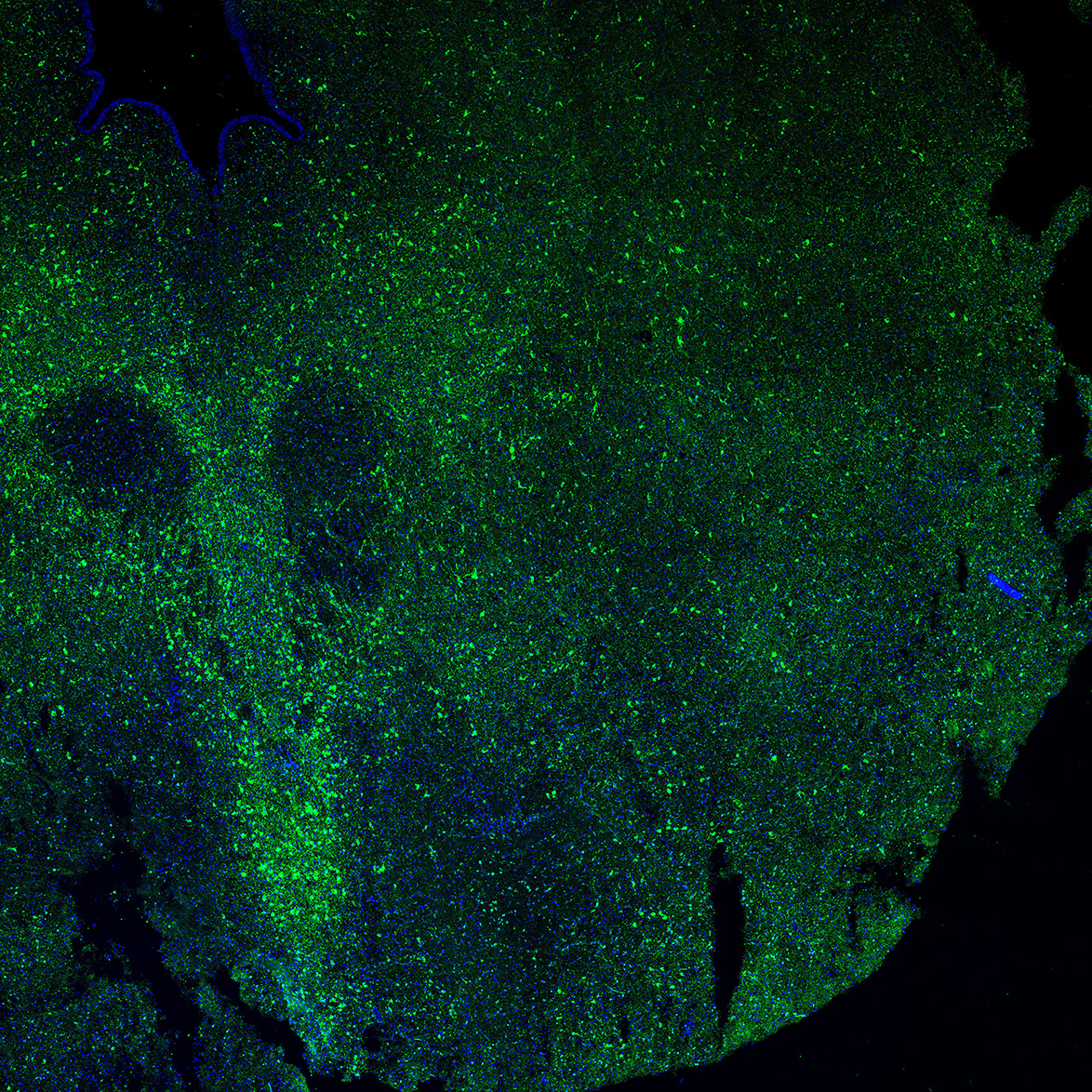 Human foetal midbrain