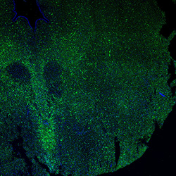 11PCW human midbrain