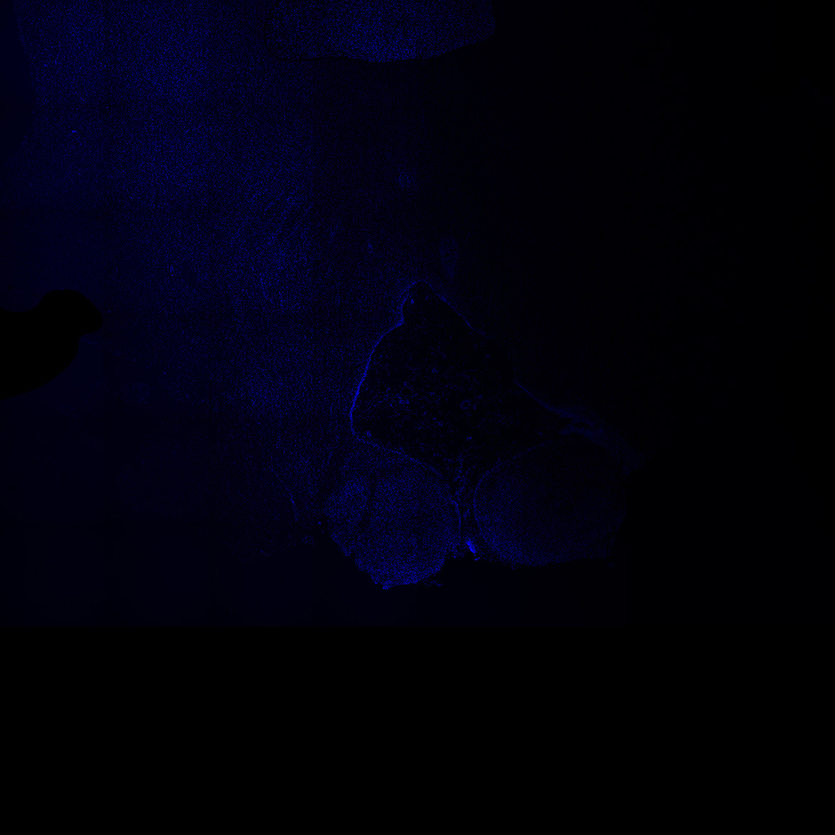 Human foetal midbrain