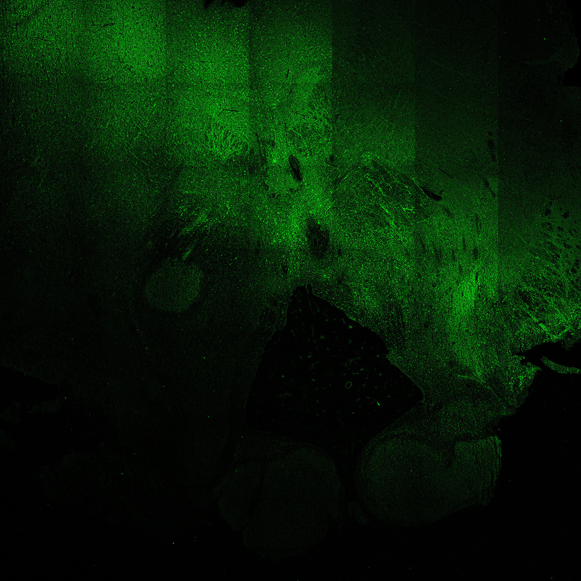 Human foetal midbrain