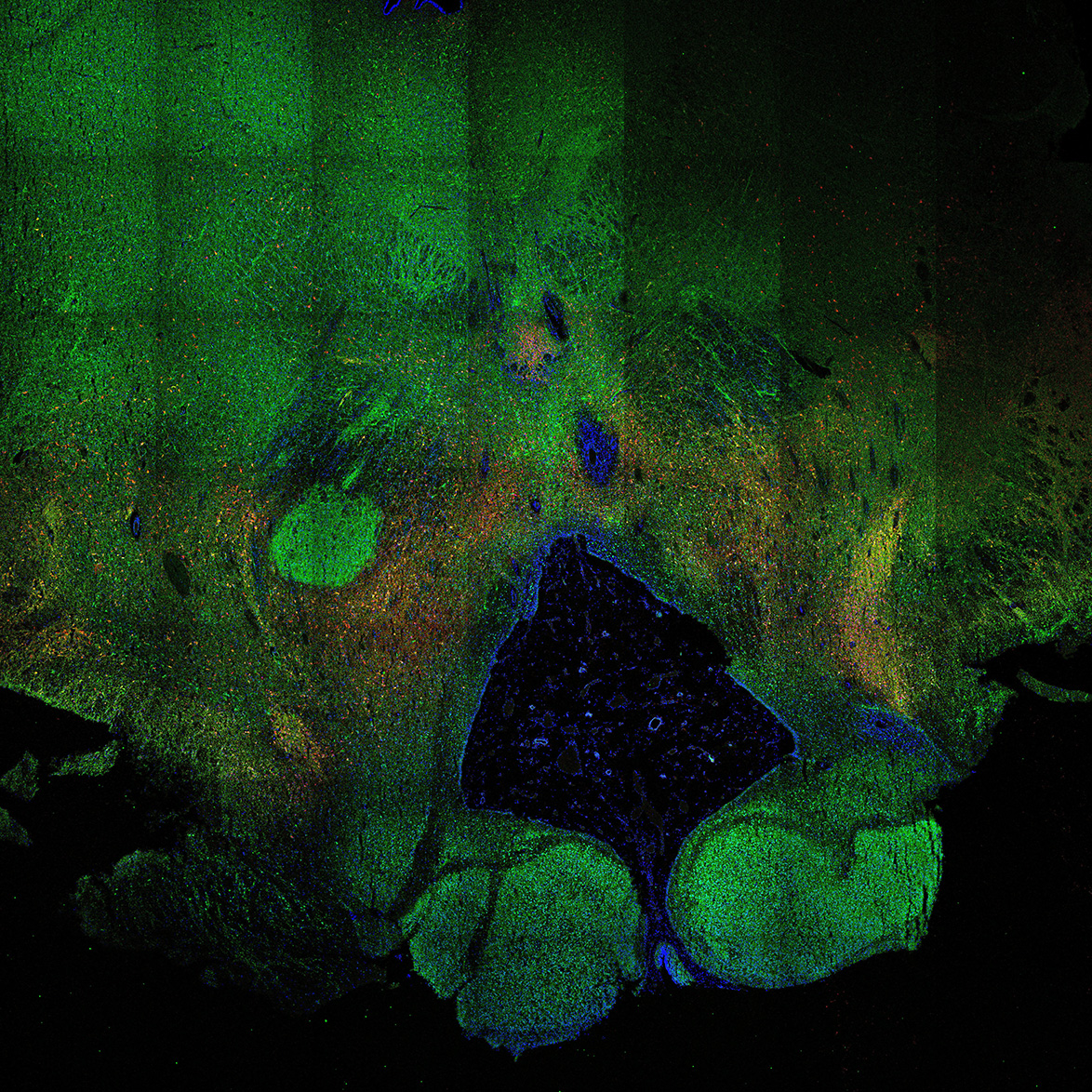 Human foetal midbrain