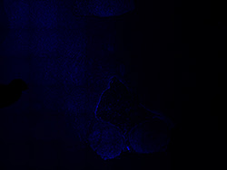 19PCW human midbrain