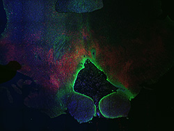 19PCW human midbrain