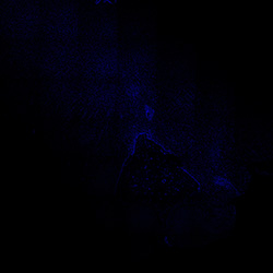 19PCW human midbrain