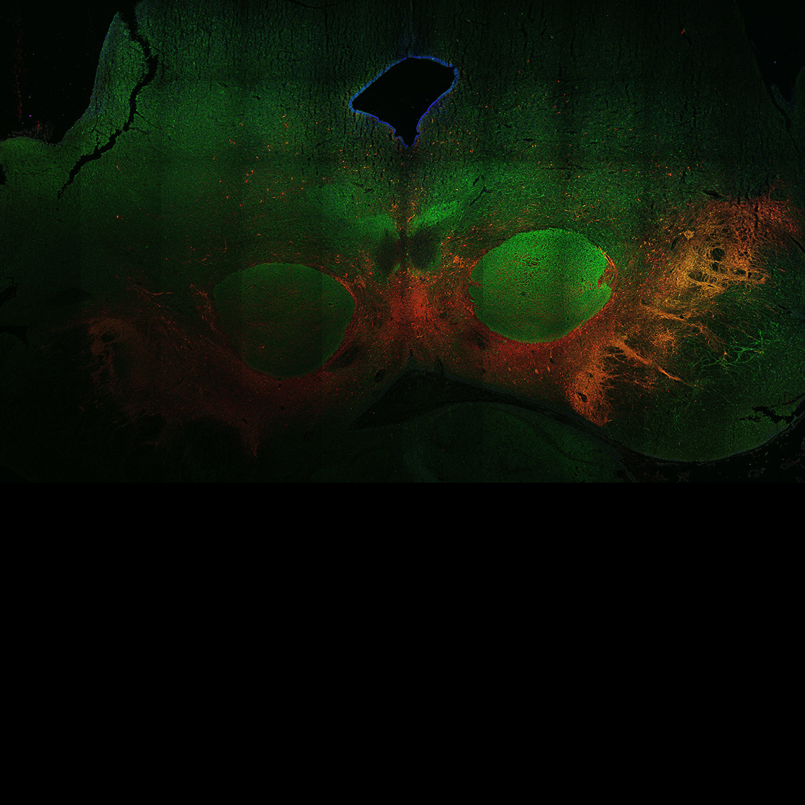 Human foetal midbrain