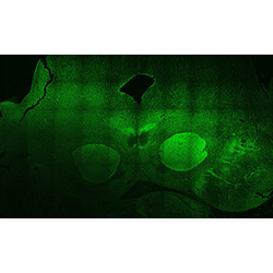 22PCW human midbrain