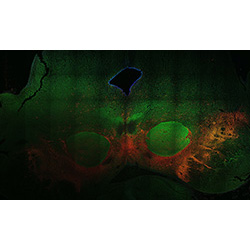 22PCW human midbrain