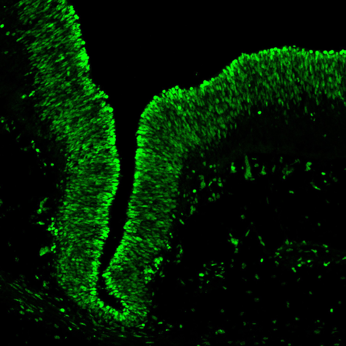 Human foetal midbrain
