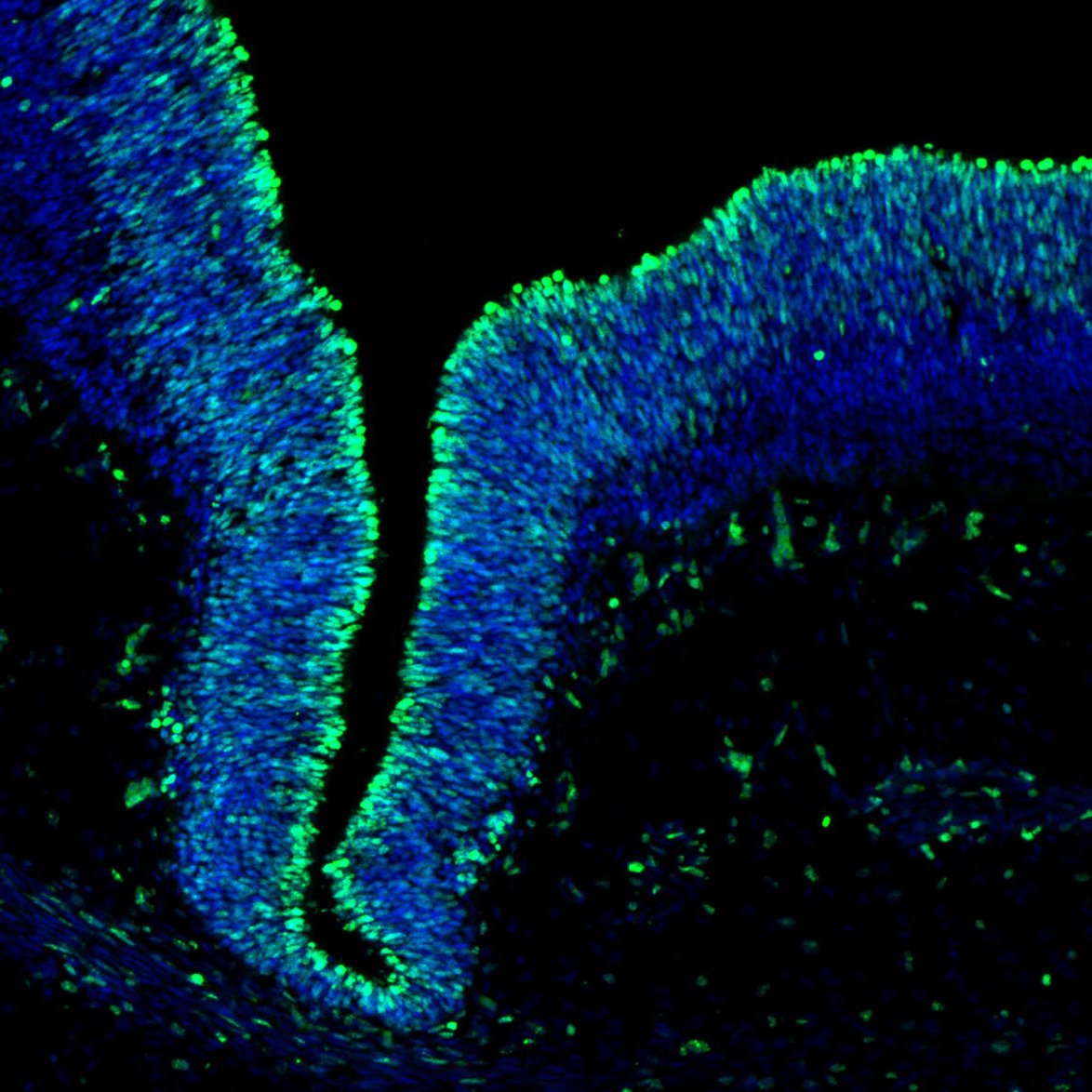 Human foetal midbrain